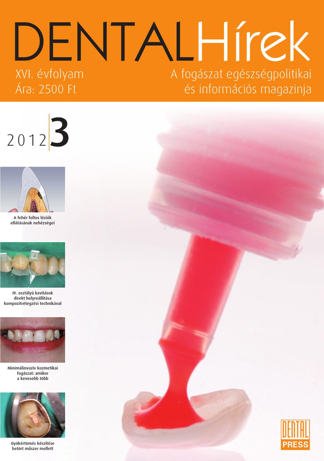 Dental Hírek 2012 3. szám by Dental Press Hungary issuu